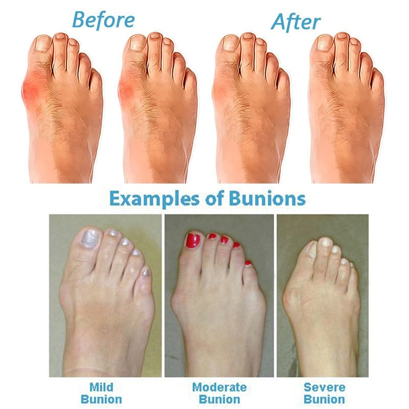 Women's Walking Sandals | Orthopedic Wedge